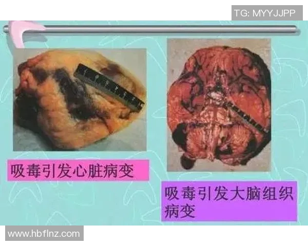 足球明星吸毒丑闻揭秘盘点那些曾因毒品而饱受争议的球员们 足球明星吸毒丑闻揭秘盘点那些曾因毒品而饱受争议的球员们